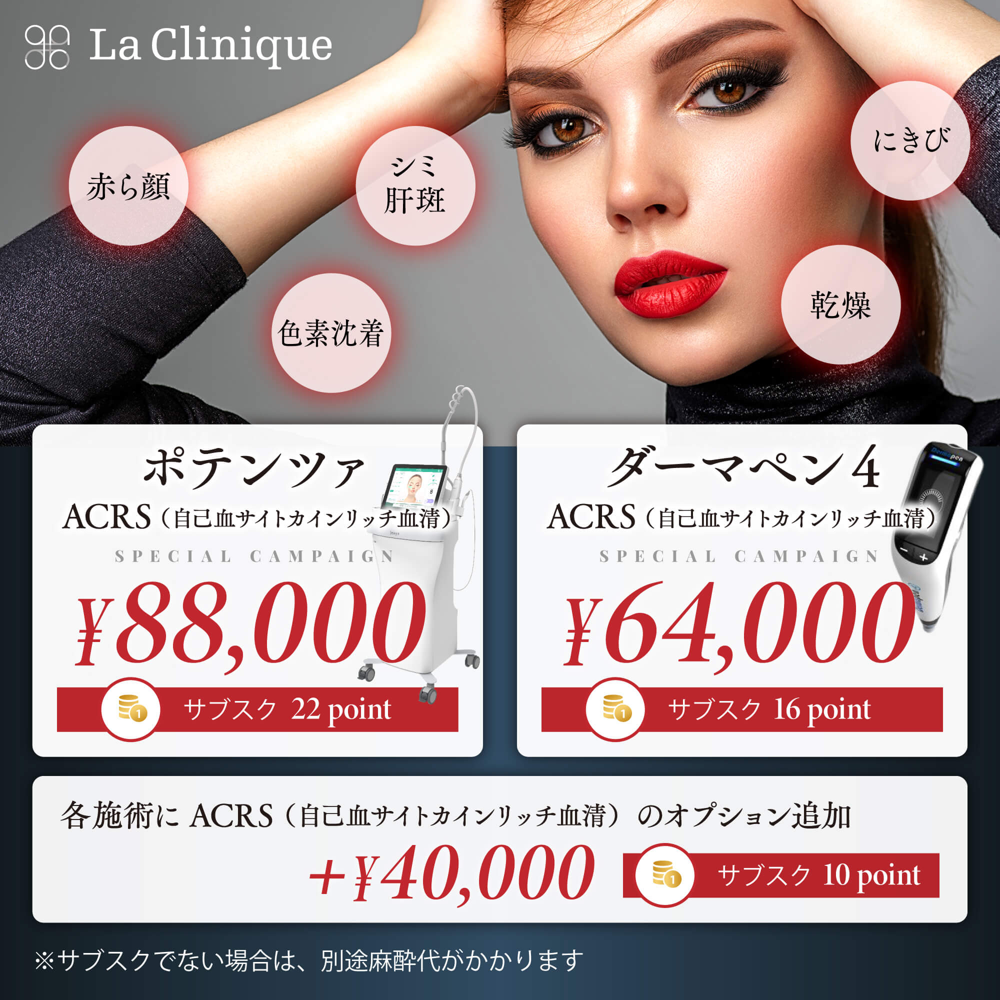 ポテンツァ、ダーマペン4