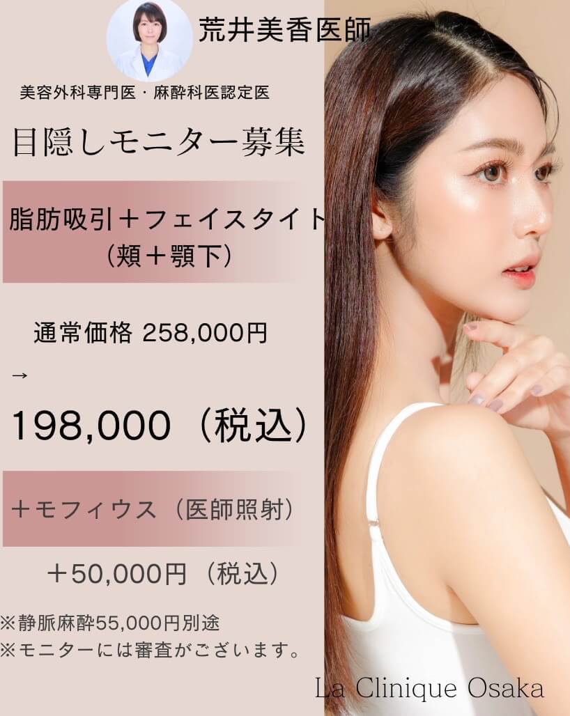 脂肪吸引・フェイスタイト・モフィウス