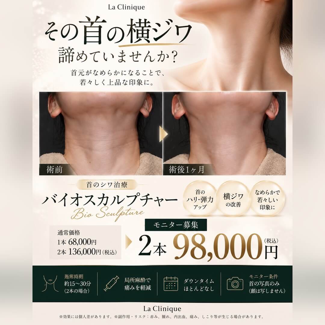 バイオスカルプチャー
