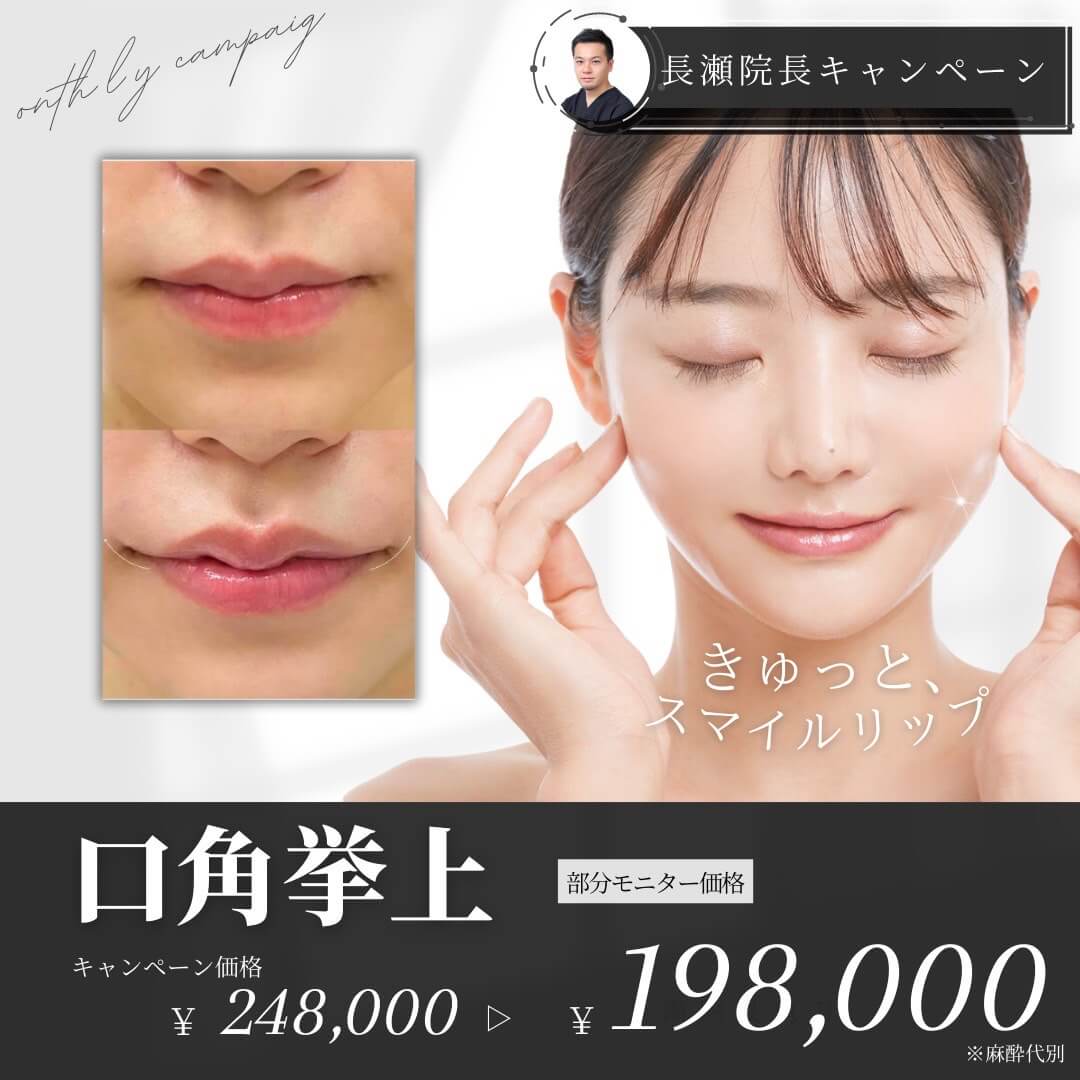 口角挙上
