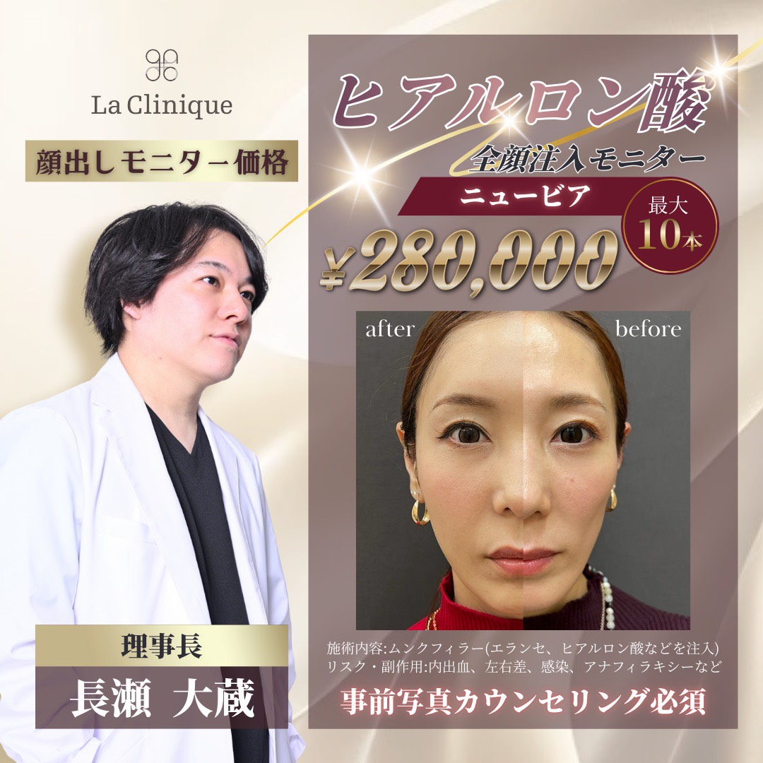 ヒアルロン酸・全顔注入キャンペーン