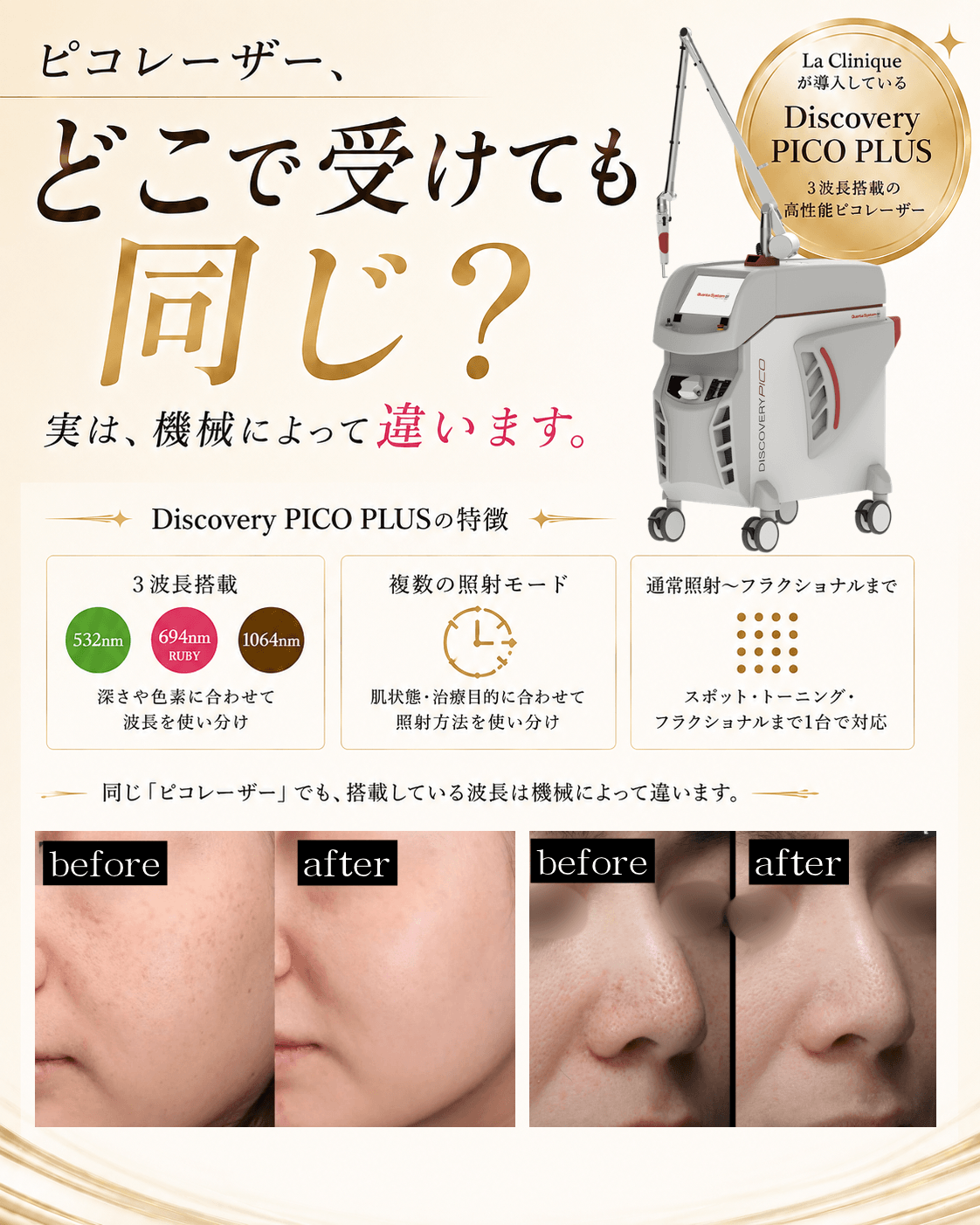 ピコレーザー、どこで受けても同じ?